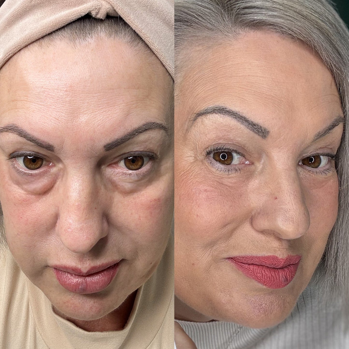 K-AURA EYES : Le soin nouvelle génération du contour des yeux